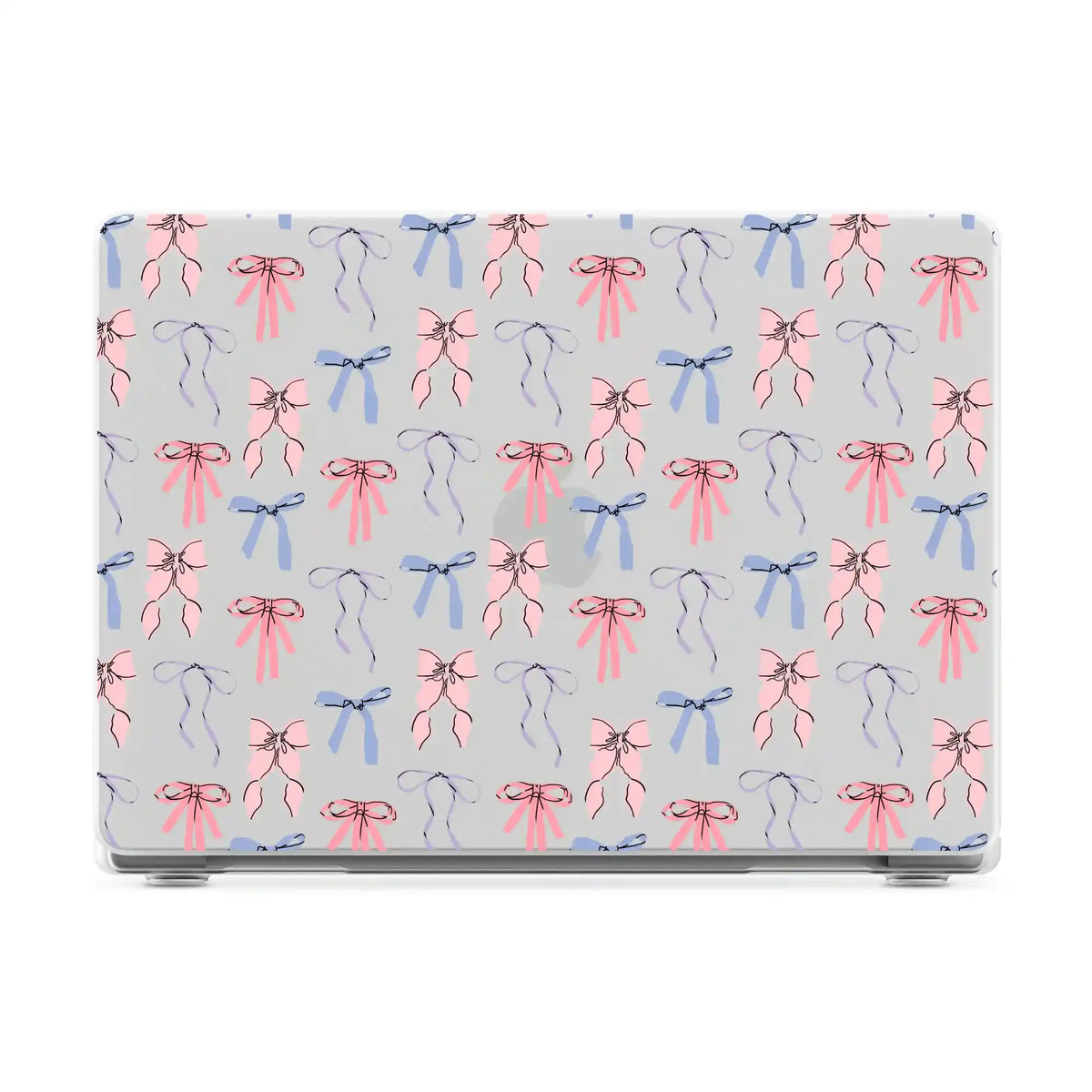 Coquette Girlie | Pastel Bows Laptop Shell